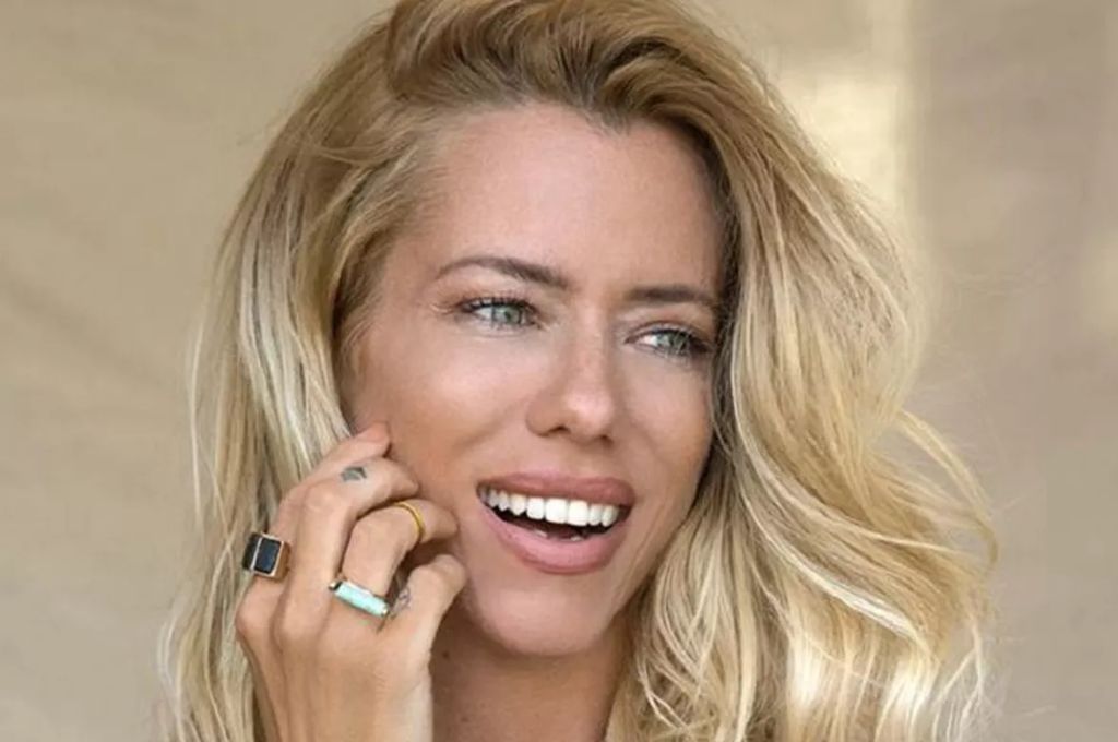 El tratamiento estético que se hizo Nicole Neumann es tendencia