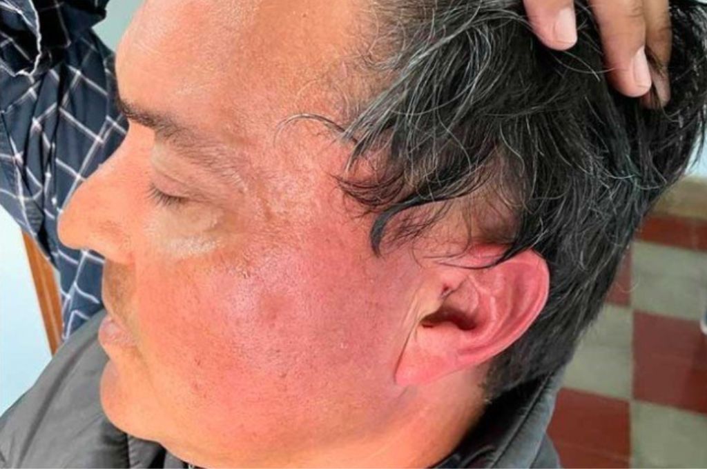 Escándalo en Villa Saralegui: el Presidente comunal y su hijo atacaron brutalmente a un productor
