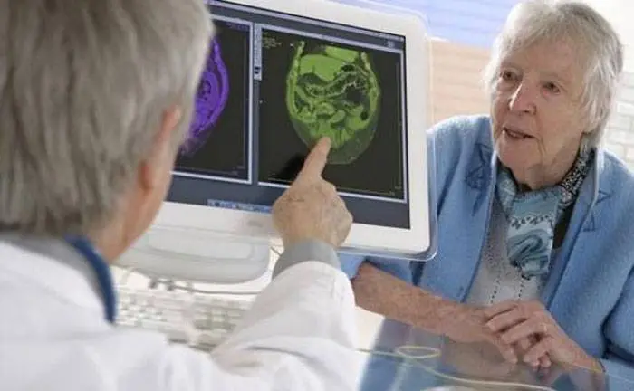 La inmunoterapia llega al Alzhéimer