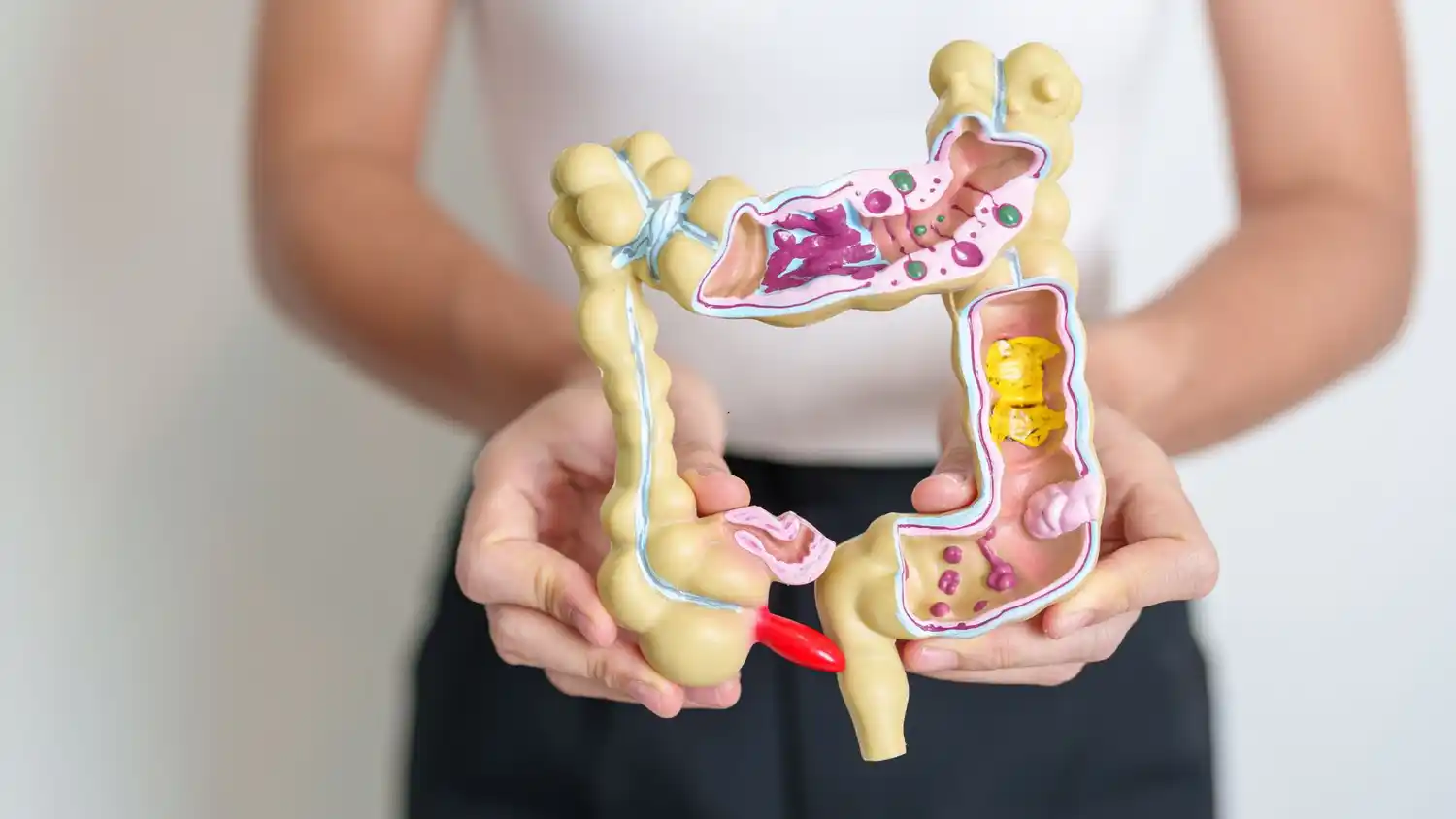 Crecen los diagnósticos de SIBO en la ciudad y advierten sobre las implicancias del estrés, la mala alimentación y la falta de descanso