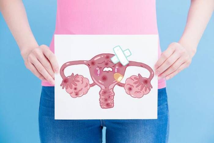 Más del 95 % de los casos de Cáncer  de Cuello Uterino son causados  por el virus papiloma humano (VPH)