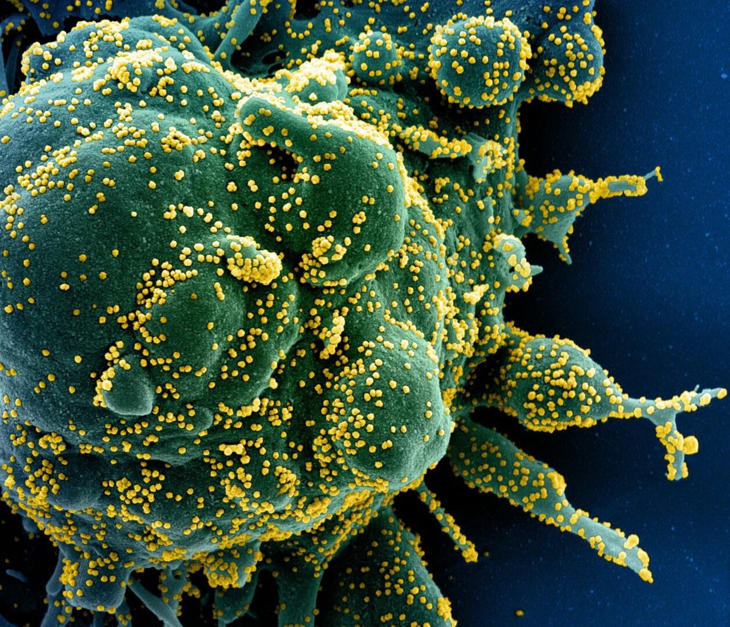 ¿La palabra virus tiene plural?, esto dice la Rae