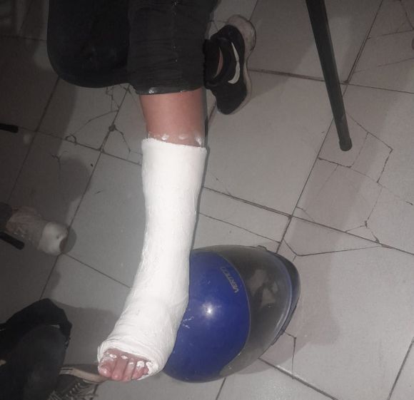 Buscan a una mujer que conducía el auto que aplastó el tobillo a un niño