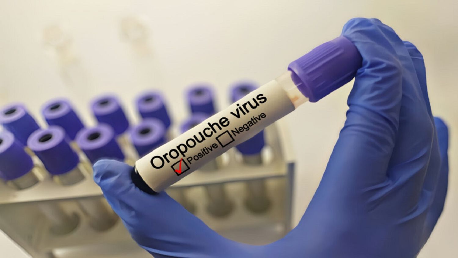 ¡ALERTA! Gobierno confirma 5 casos del virus OROPOUCHE en Venezuela (+Comunicado)