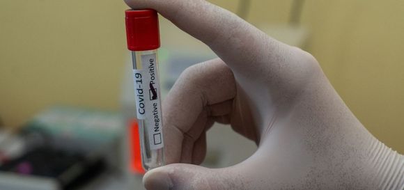 Segunda ola de coronavirus: confirmaron cuatro nuevos casos positivos y hay 47 muestras pendientes