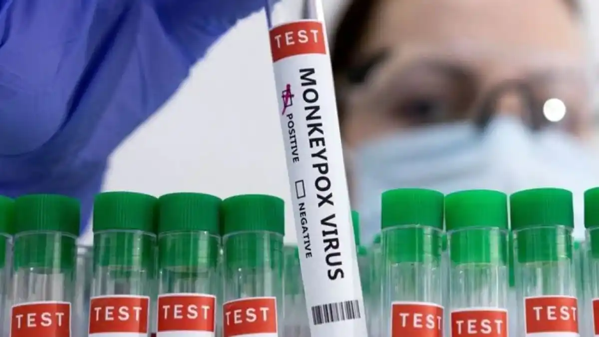 Detectaron tres nuevos casos de viruela sísmica en Argentina