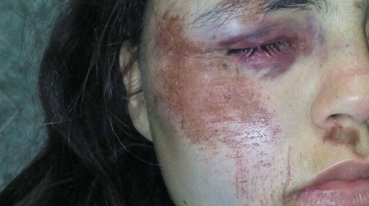 Carhué: Violó la perimetral y con tres hombres atacó a su ex