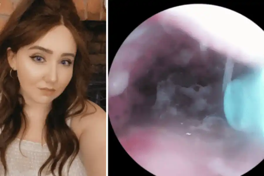 Le picaba el oído y encontró allí algo que nadie quisiera encontrar