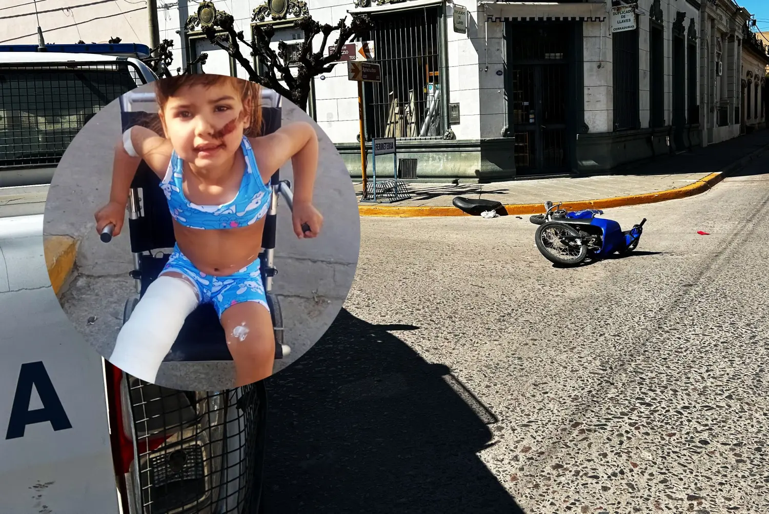 Valentina debe ser operada para la colocación de tornillos de fijación ortopédica.
