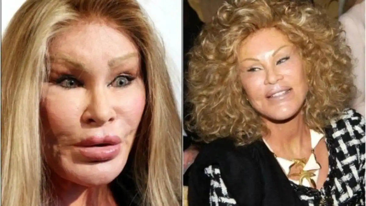 Fallece Jocelyn Wildenstein: la socialité neoyorquina conocida como la «mujer felina»