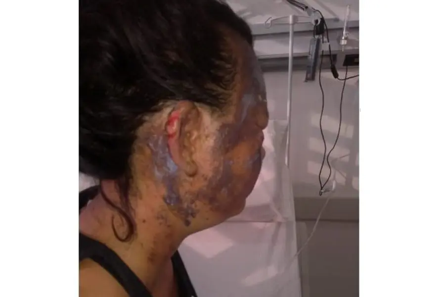 “Me vengo a entregar, le prendí fuego a mi novia”, dijo tras un intento de femicidio en Coronda
