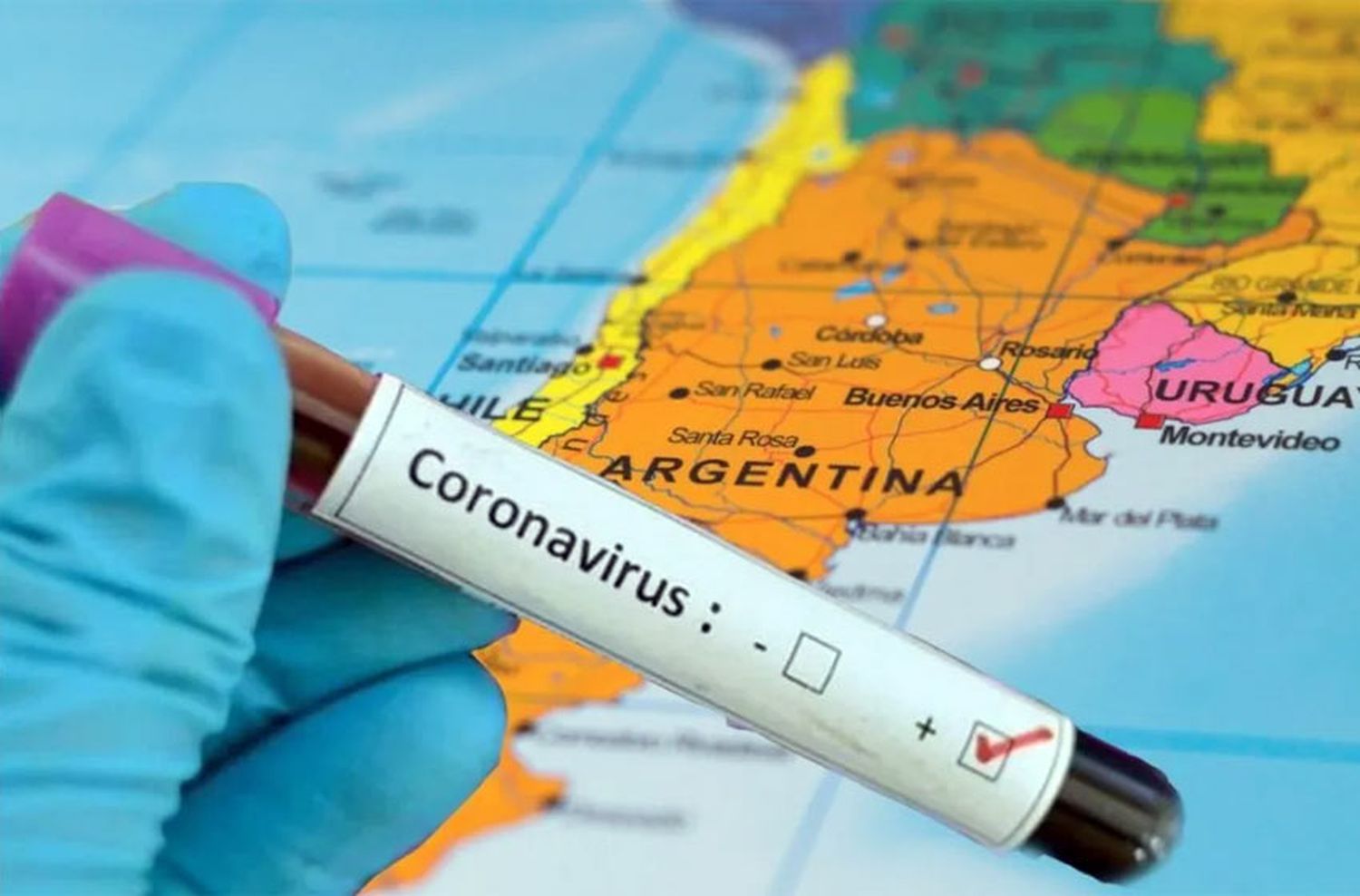 Investigadores argentinos fueron elegidos para probar una vacuna contra el coronavirus