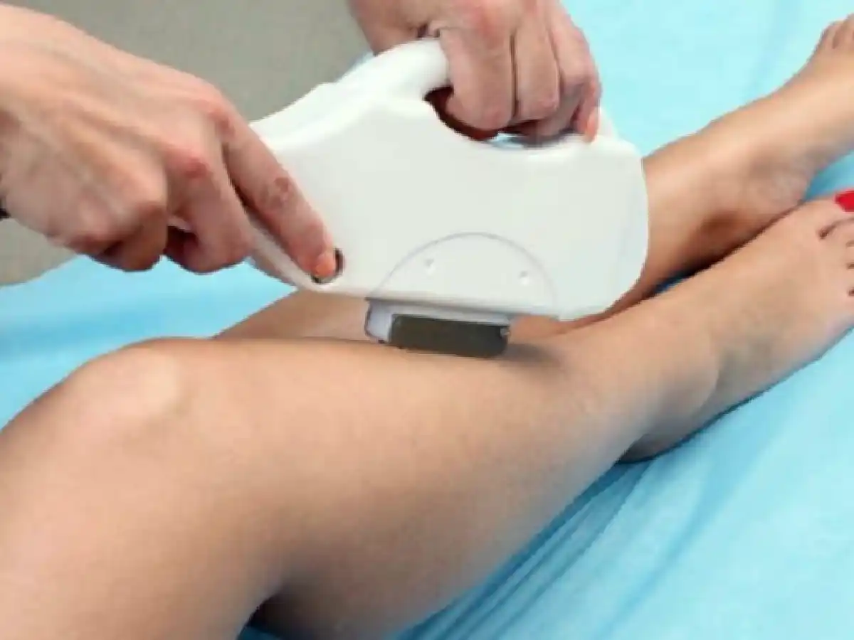 Se fue a depilar, la quemaron y ahora deberán indemnizarla