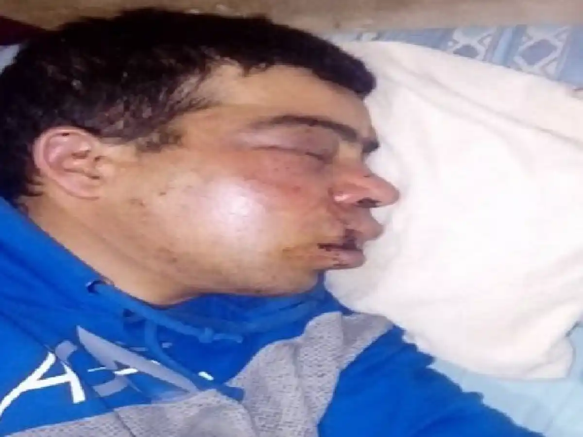 Otra salvaje golpiza a un joven en la ciudad 