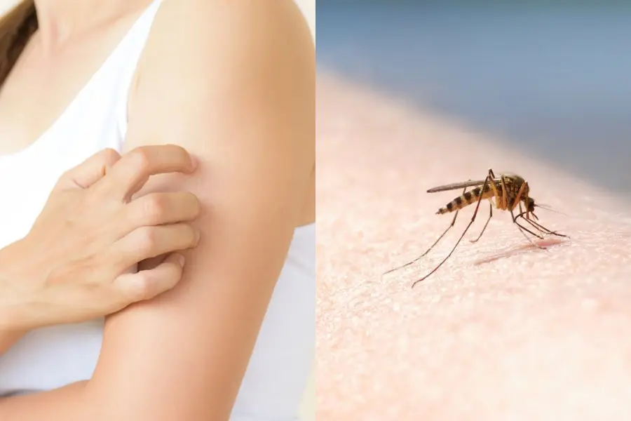 Descubren por qué los mosquitos pican más a unas personas que a otras