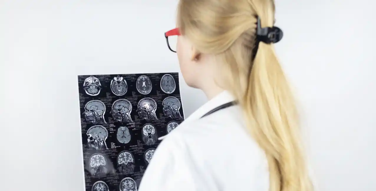 Día Internacional de la Epilepsia: lo que tenés que saber