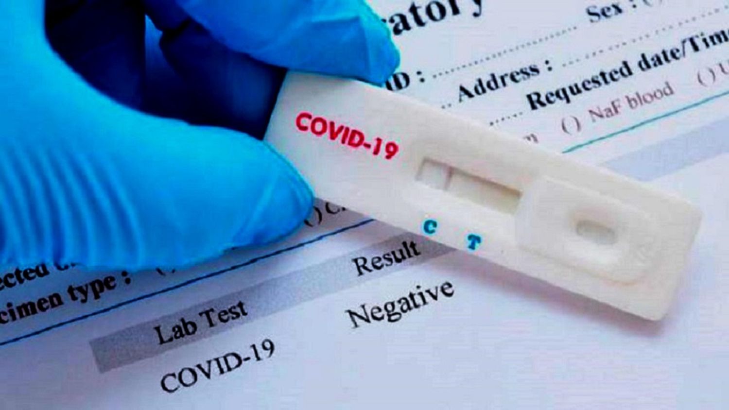 Advierten a un intendente por realizar test rápidos con personal no autorizado