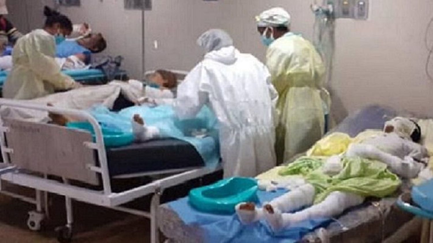 QUEMADOS en la explosión de Monagas padecen sin recibir atención ni medicamentos