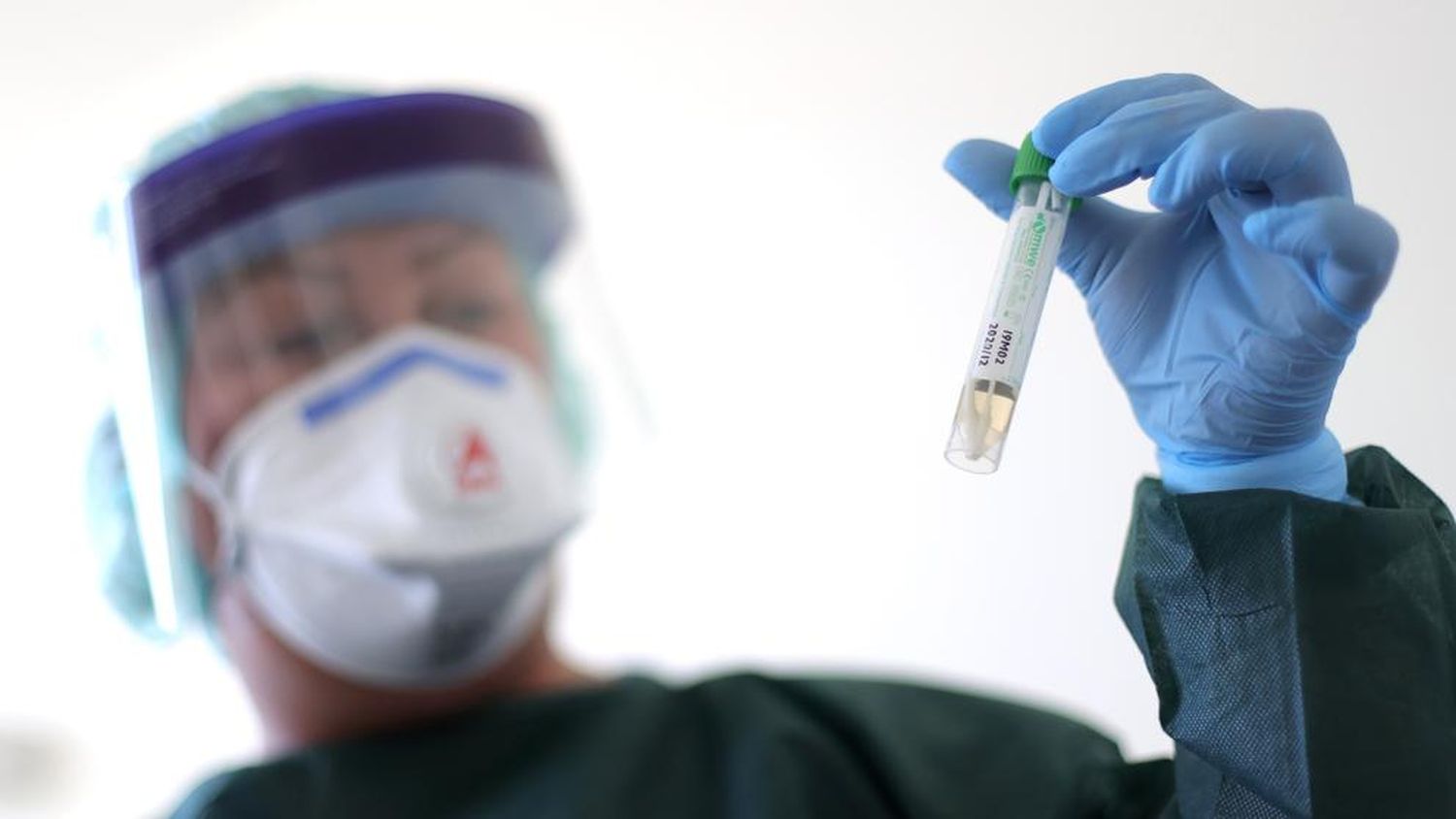 Coronavirus: La importancia de seguir reforzando las medidas de prevención