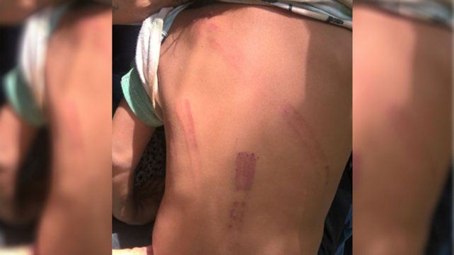 Imputaron a una entrerriana por torturar a sus hijos de 2, 4 y 6 años