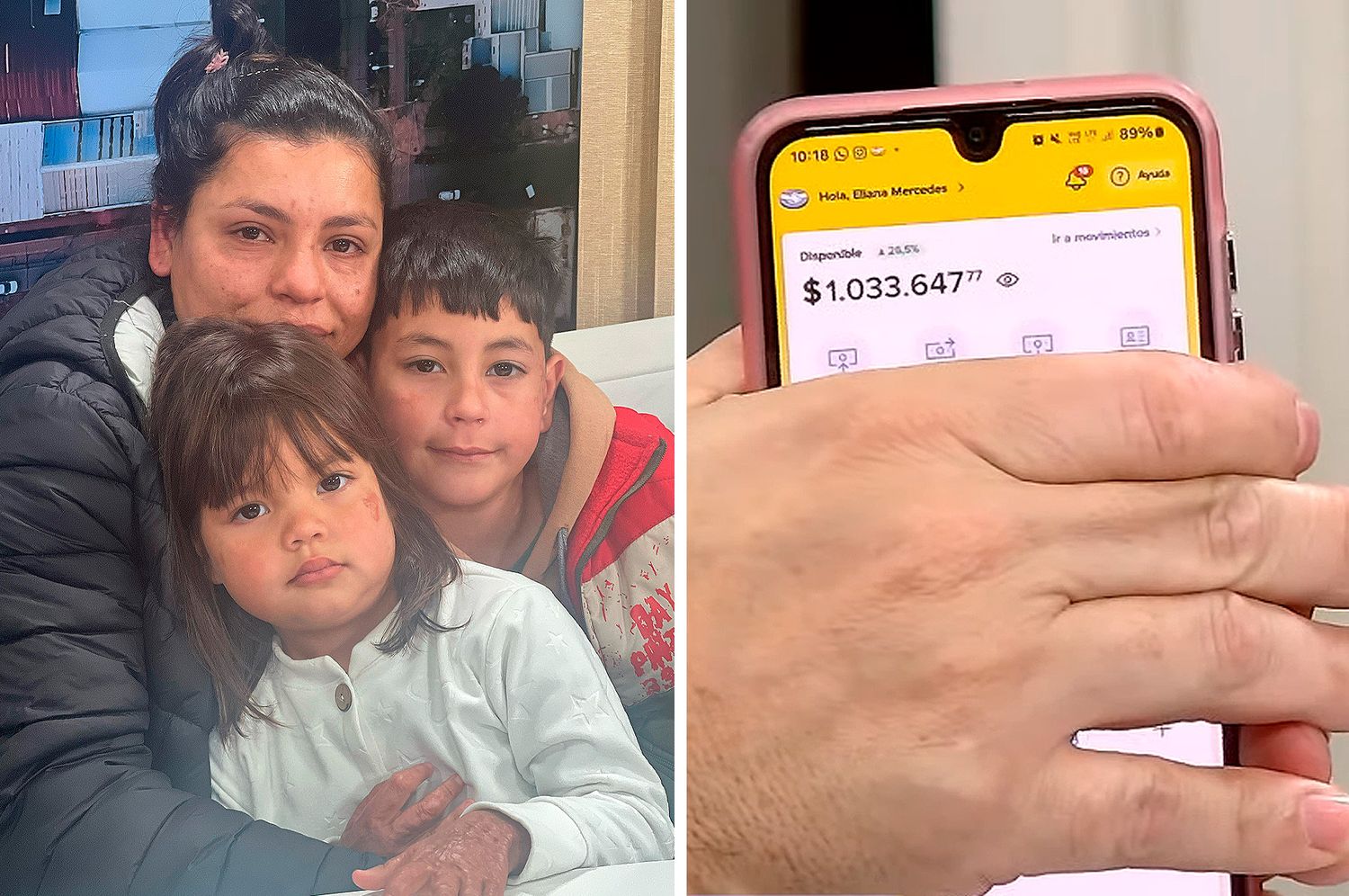 A un año del incendio en barrio Mora, Loan necesita ayuda para otra operación urgente: ¿cómo ayudar?