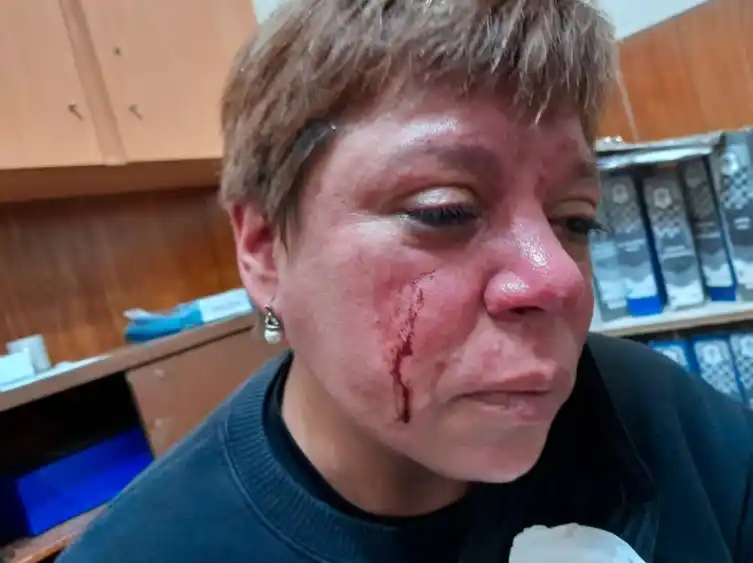Brutal agresión a una inspectora municipal en una hamburguesería de La Plata: Recibió piñas y le cortaron el rostro