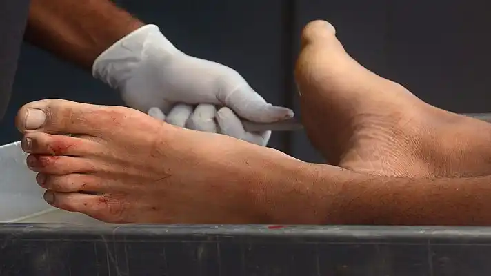 Para robarle 800 dólares matan a un abogado en Caracas