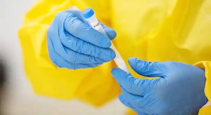 Los anticuerpos contra el SARS-CoV-2 no son eternos