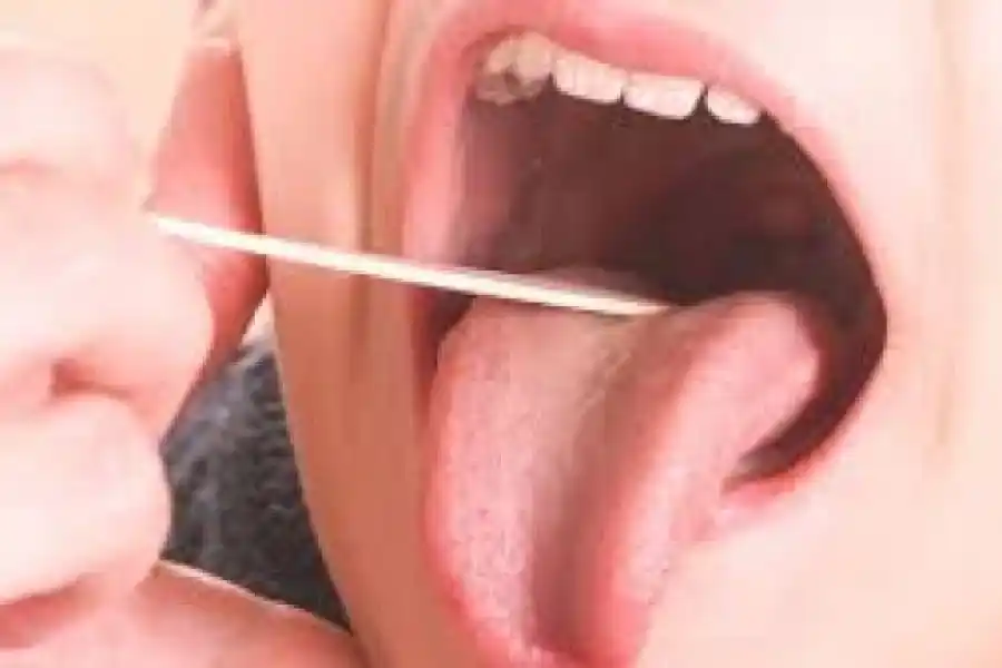 Sonia Martorano: "El Streptococcus pyogenes existe desde siempre"