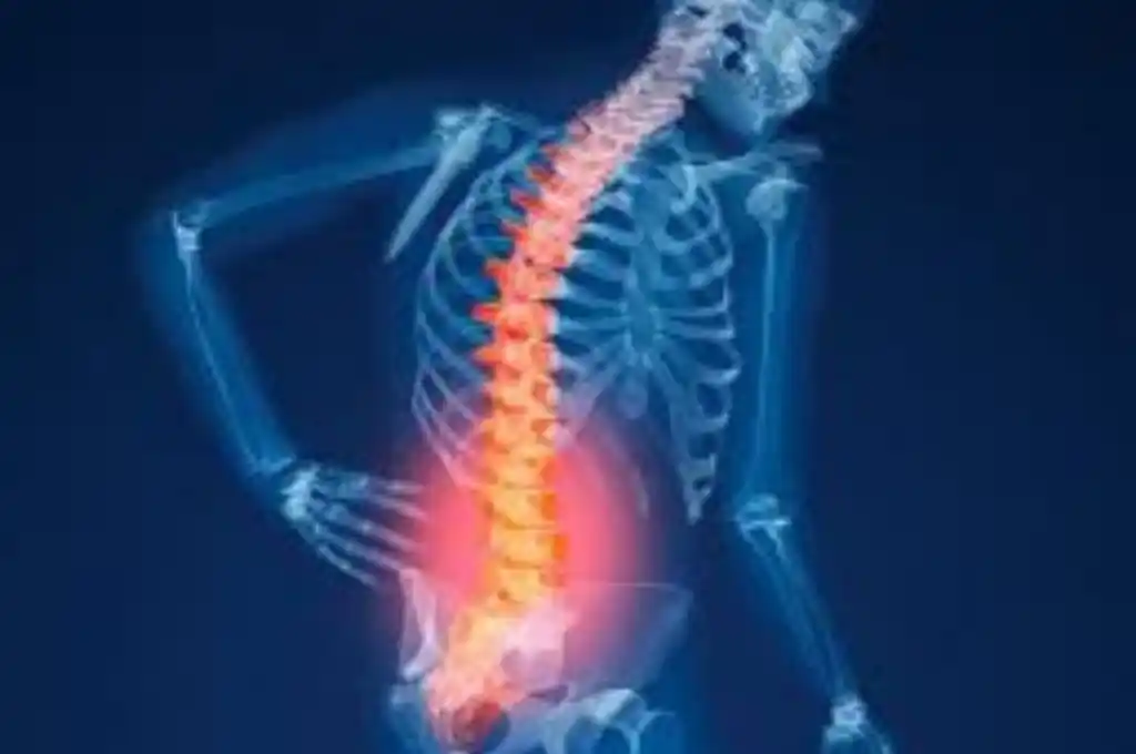 Osteoporosis: se producen 90 fracturas de cadera por día por esta condición en Argentina