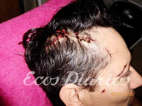 Dos imputados por herir a un comisario en una pelea vecinal