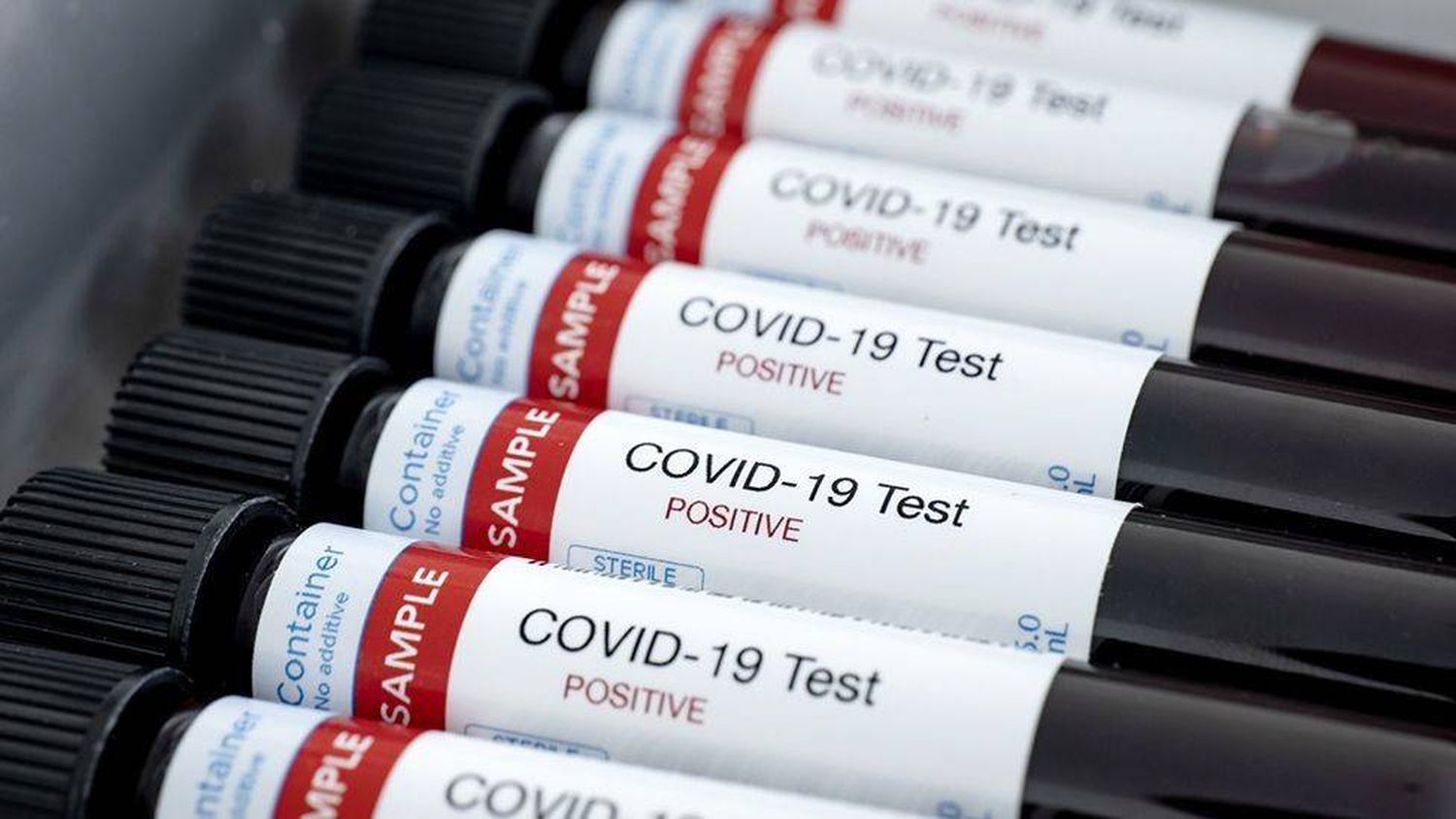 Concordia registró 46 nuevos casos de coronavirus
