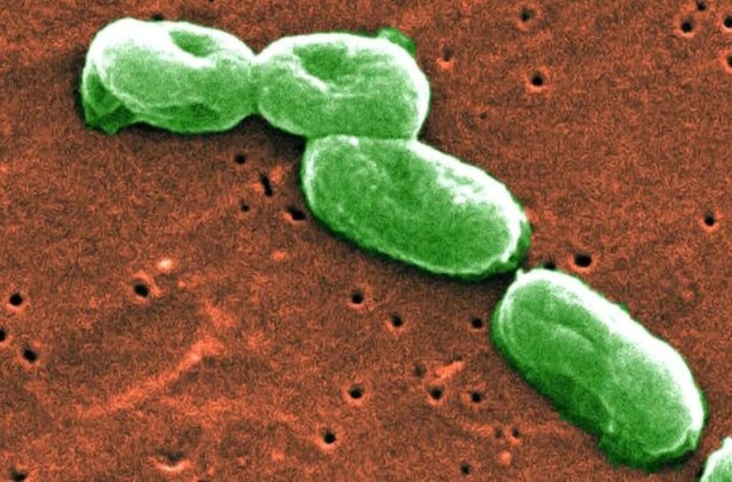 Investigadoras de la UNLP buscan formas de combatir la resistencia de bacterias desde su envoltura celular