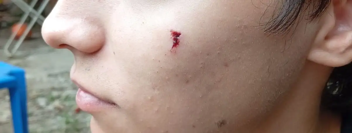 culetazo en cara a un chico asaltado vía crucis