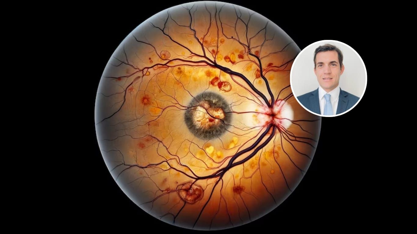 Aníbal Francone integra el equipo argentino premiado internacionalmente por innovadora cirugía ocular.