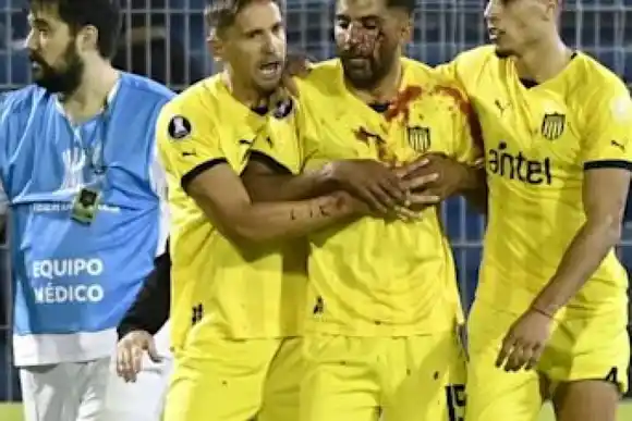 Un jugador de Peñarol fue agredido con un proyectil tras el partido ante Central