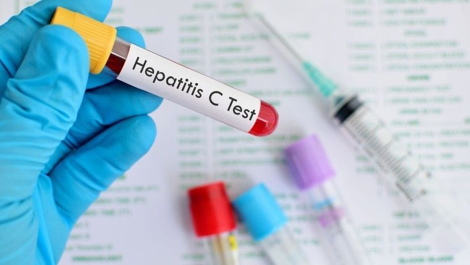 28 de julio: Día Mundial contra la Hepatitis