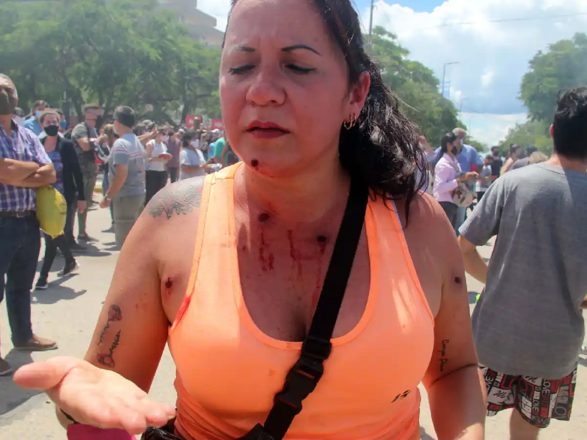 Protestas y manifestantes heridos tras el anuncio de regreso a Fase 1 en la ciudad de Formosa