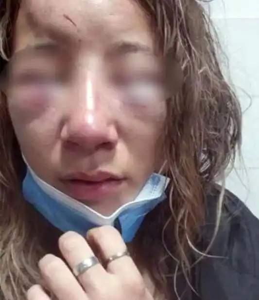 Una chica fue torturada a la salida de un boliche: la golpearon y le arrancaron las uñas