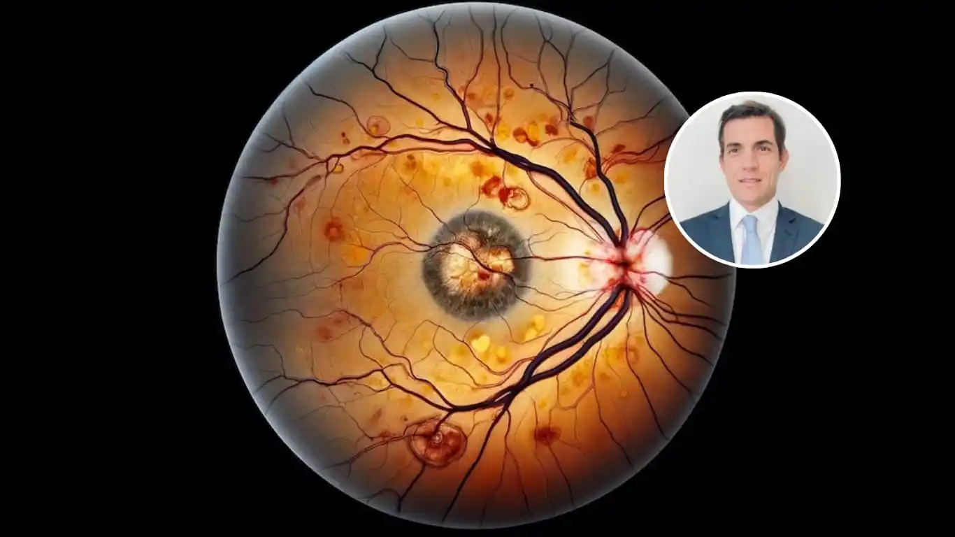 Aníbal Francone integra el equipo argentino premiado internacionalmente por innovadora cirugía ocular.