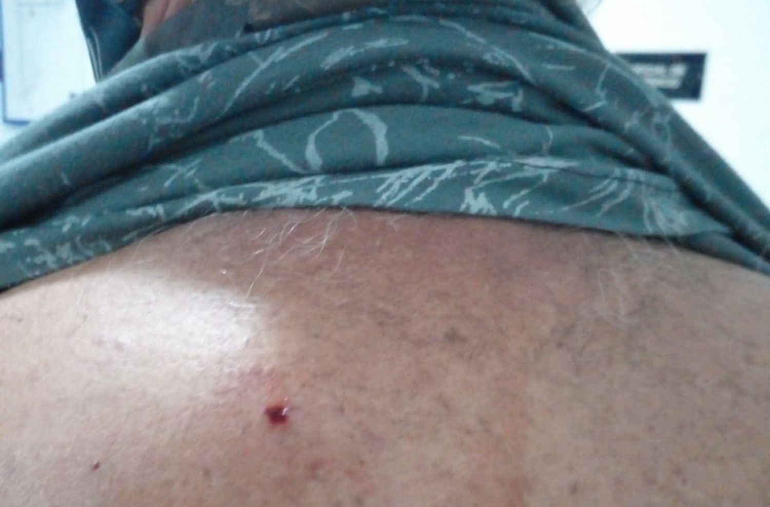 Manteros atacaron y lastimaron a la Policia y a municipales en la Peatonal