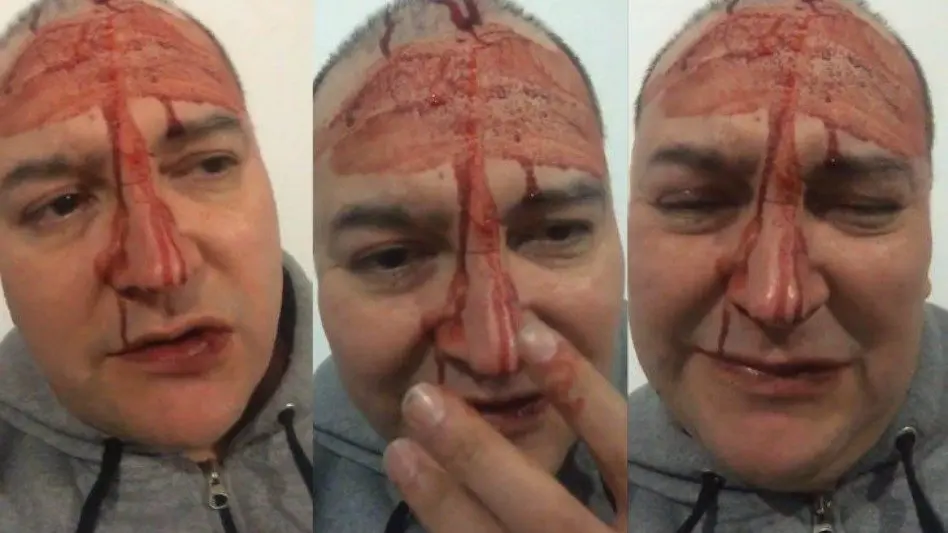 Leo García sufrió un ataque homofóbico