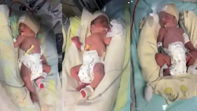 Uno de los trillizos recien nacidos atraviesa una situación compleja: “Pedimos una cadena de oración”