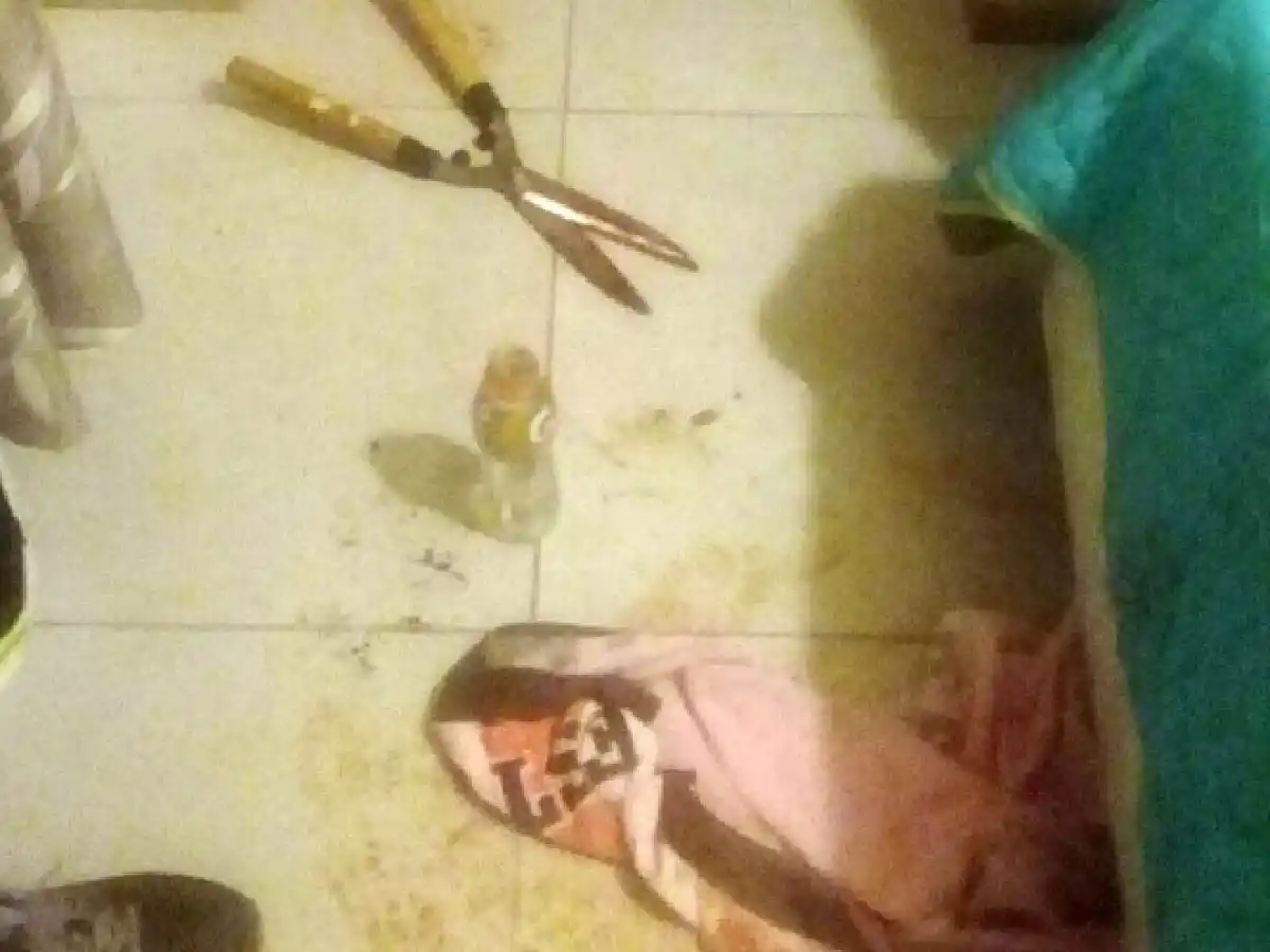 Una joven hirió a su amante en los genitales con una tijera de podar