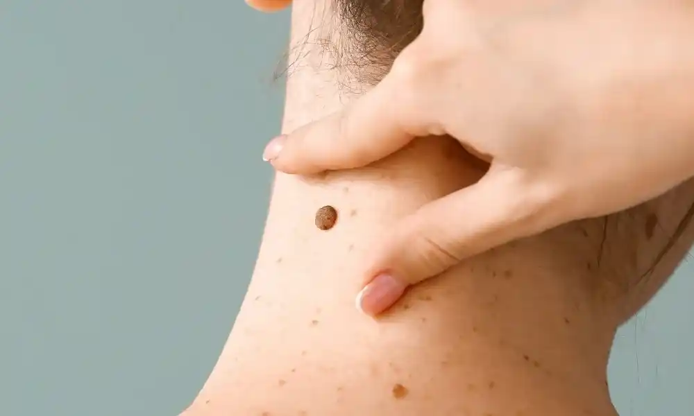 Los niños deben usar protección total, mientras que los menores de un año no deben exponerse al sol bajo ningún término.