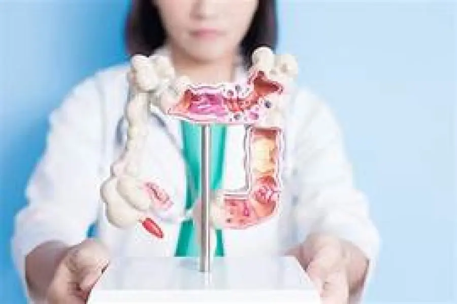Se diagnostican casi 2 nuevos casos de cáncer de colon por hora en Argentina