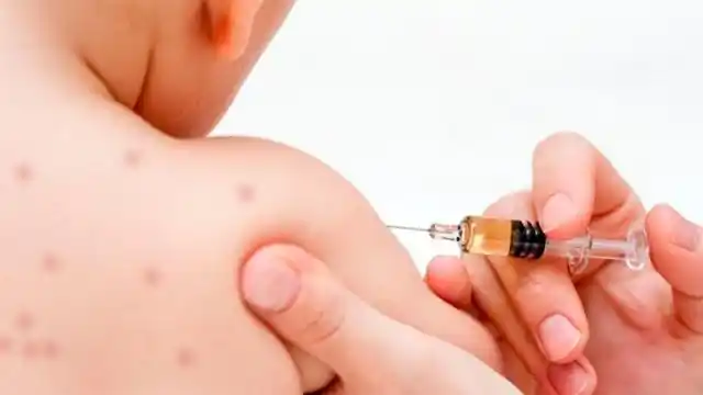 Confirmaron 18 casos de sarampión en Argentina y anunciaron nuevas medidas