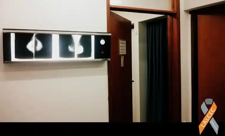 Lalcec y Alma Gaucha lanzan la rifa de un 0km por un nuevo mamógrafo