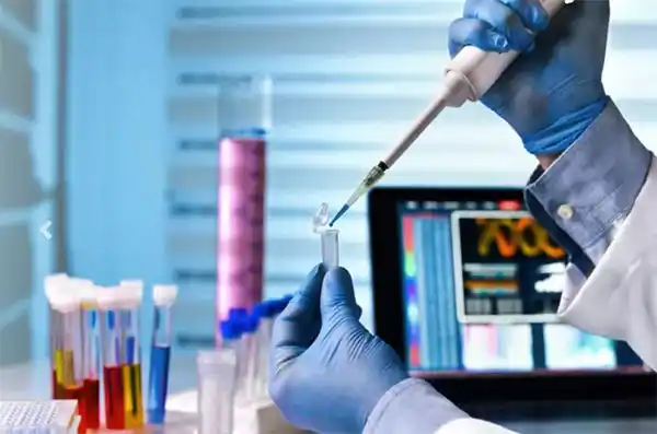Informan otros 29 fallecimientos y ascienden a 1.749 los muertos por coronavirus