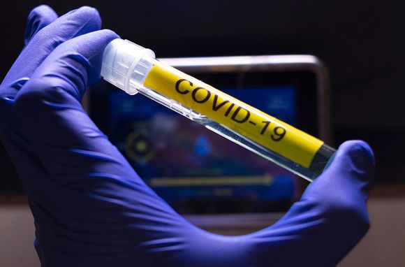 Coronavirus en Argentina: reportan 53 nuevos fallecidos y 3.937 nuevos contagios